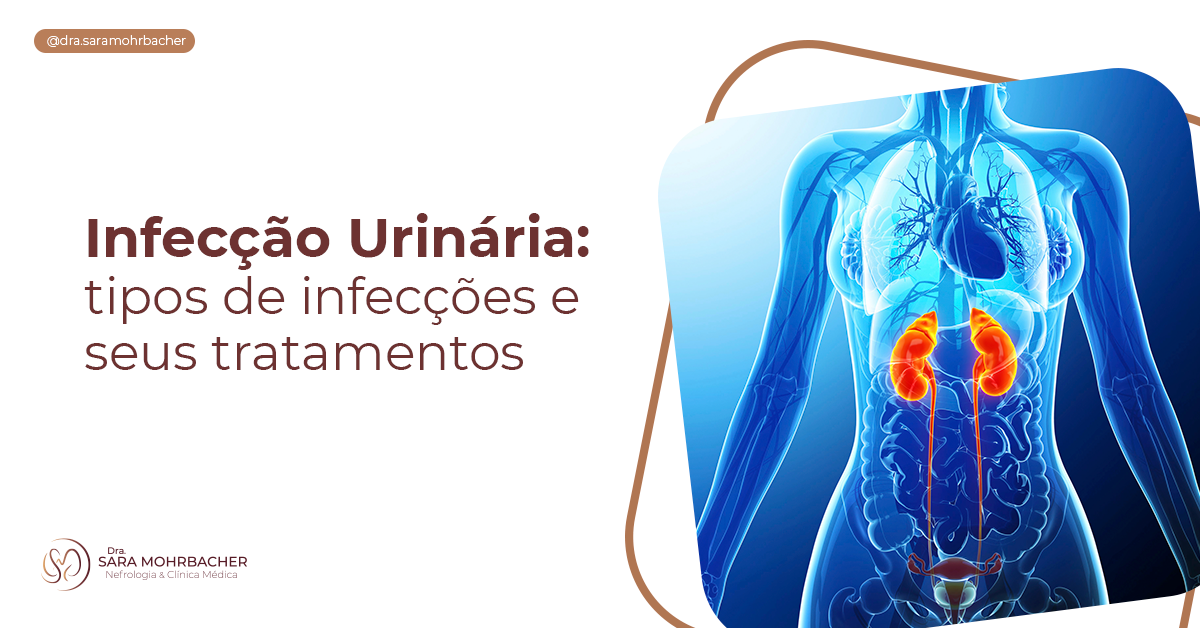 Infecção Urinária tipos de infecções e seus tratamentos Dra Sara