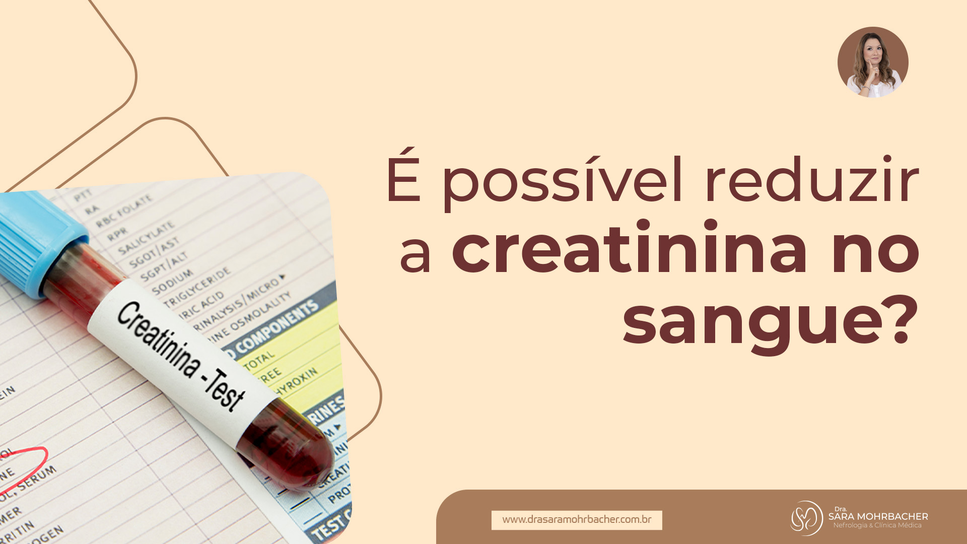 É possível reduzir a creatinina no sangue? - Dra. Sara Mohrbacher