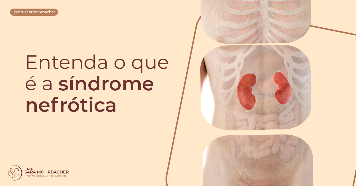 Sindrome Nefrotica Renal