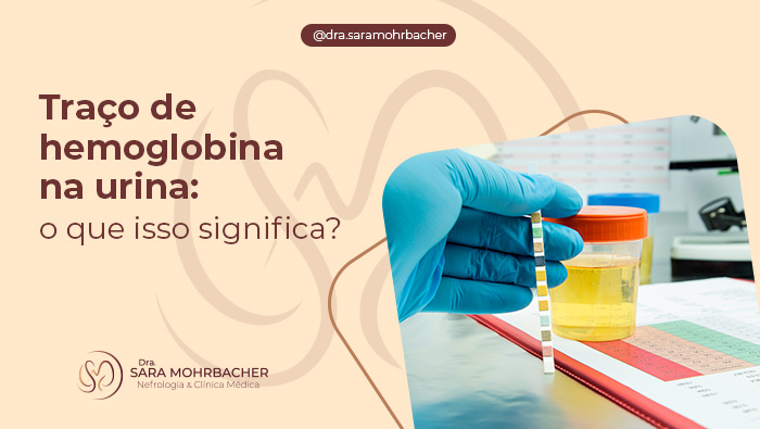 Mão com luva azul segura fita de teste de urina diante de recipiente coletor amarelo, sobre mesa com tabela de análise laboratorial.