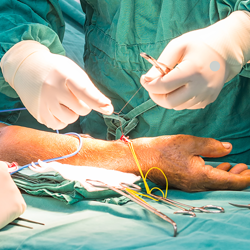 Imagem de um procedimento cirúrgico no braço, mostrando médicos com luvas realizando sutura vascular em ambiente hospitalar.