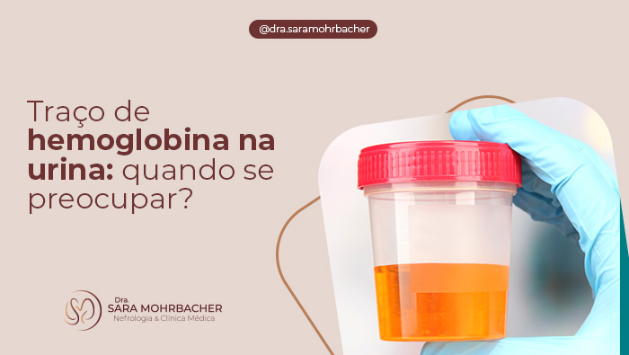 Imagem de um frasco transparente com tampa vermelha contendo amostra de urina de cor alaranjada, segurado por uma mão com luva azul.