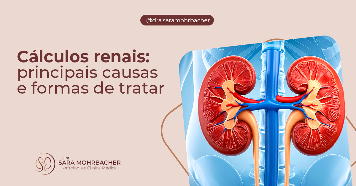 Cálculos renais: principais causas e formas de tratar - Dra. Sara ...