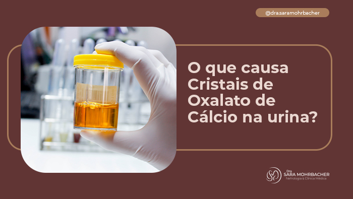 O que causa Cristais de Oxalato de Cálcio na urina? 1 Mão com luva segurando frasco de exame de urina amarelo, em ambiente de laboratório com tubos ao fundo.