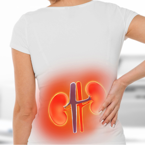 Mulher vista de costas com mão na região lombar, com ilustração destacando os rins para representar dor ou problema renal.