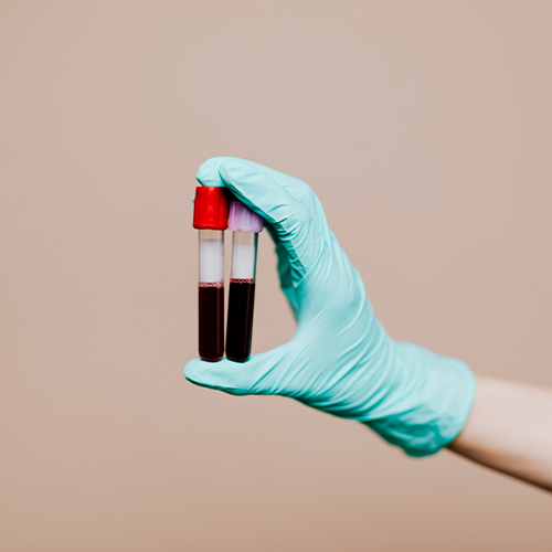 Mão com luva segura dois tubos de ensaio com amostras de sangue em fundo neutro.