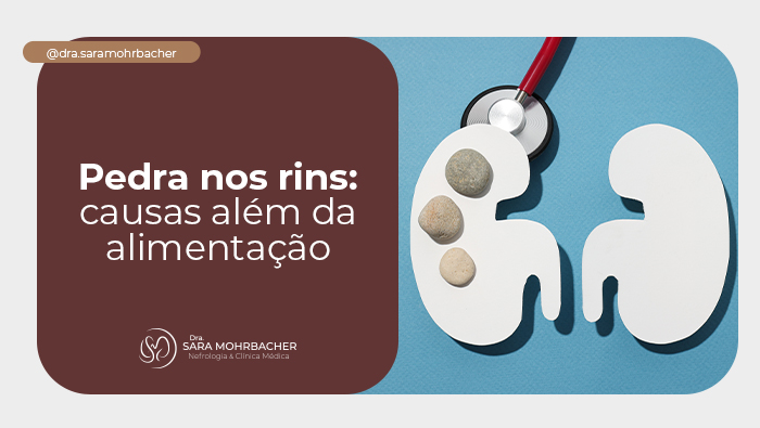 Pedra nos rins: causas além da alimentação 1 Ilustração de rins com pedras sobre um deles e estetoscópio ao lado, representando cálculo renal e avaliação médica.