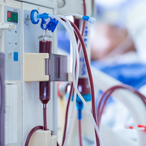 Equipamento de diálise com tubos e filtro de sangue em destaque, em ambiente hospitalar com paciente ao fundo.
