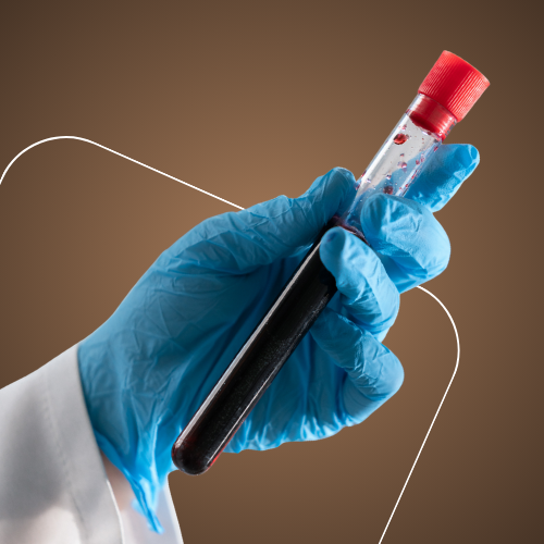 Mão com luva segurando tubo de sangue para exame