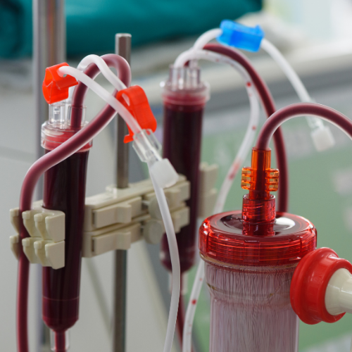 Equipamento de hemodiálise com tubos de sangue