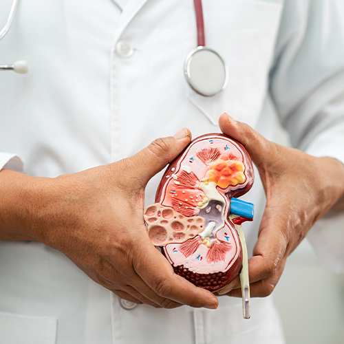 Médico segurando modelo anatômico de rim humano